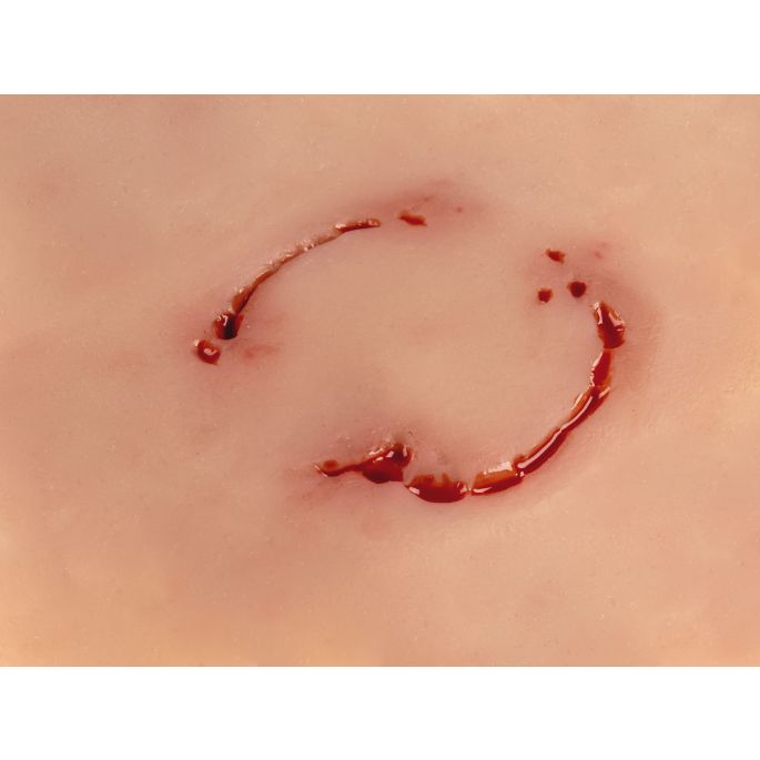 Wondmoulage 'menselijke beet' - afbeelding 5