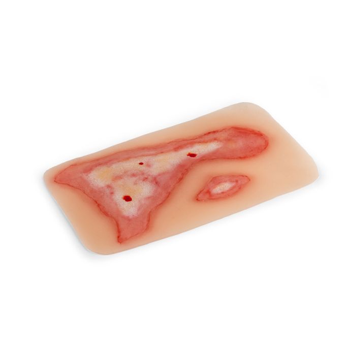 Wondmoulage broeien - afbeelding 3