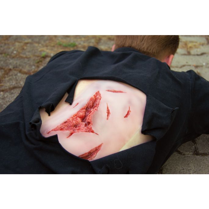 Wondmoulage laceratie
