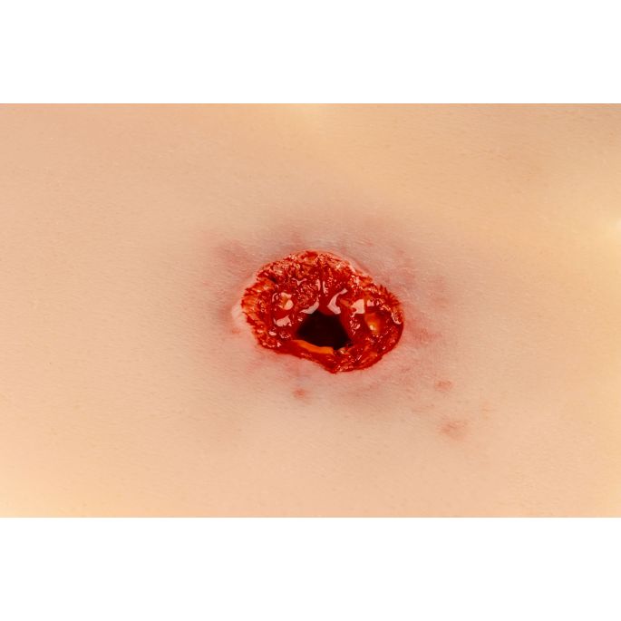  arm met bloedingsfunctie - afbeelding 3