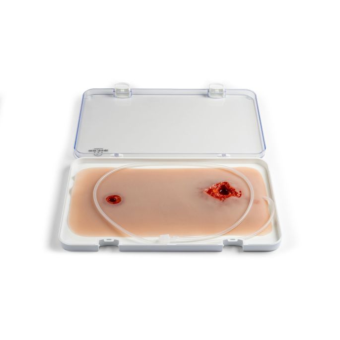 Wondmoulage kogelgat