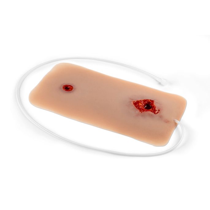 Wondmoulage kogelgat