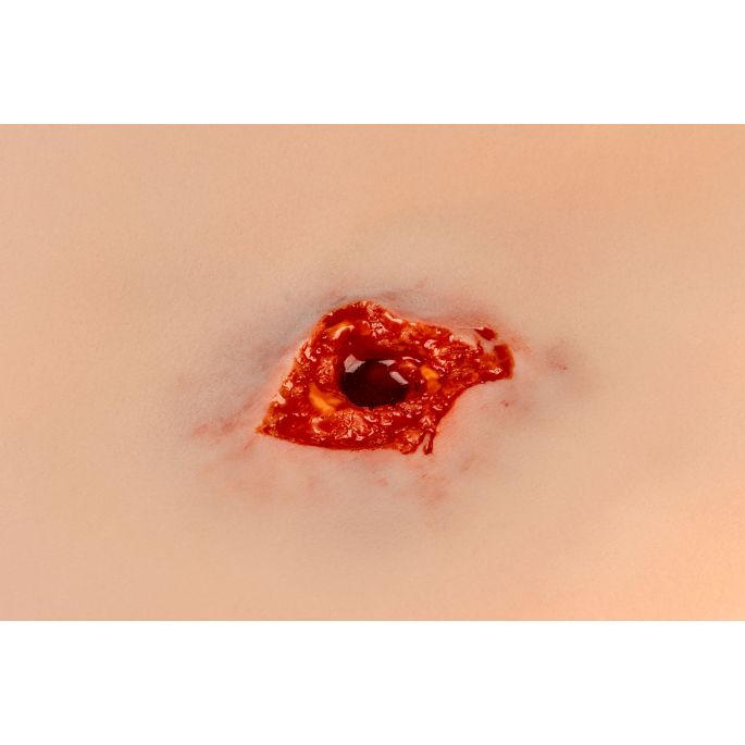 been met bloedingsfunctie - afbeelding 3