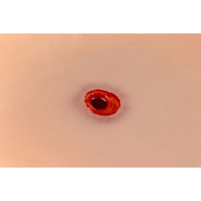 Wondmoulage kogelgat