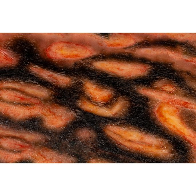 Wondmoulage 3e graads brandwond (V2) - afbeelding 5