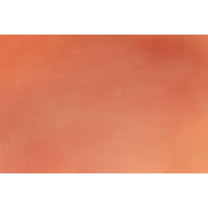 Wondmoulage 1e graads brandwond - afbeelding 5