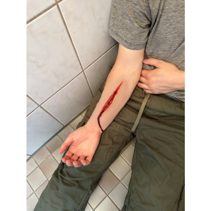 Wondmoulage Zelfmoordpoging - afbeelding 6