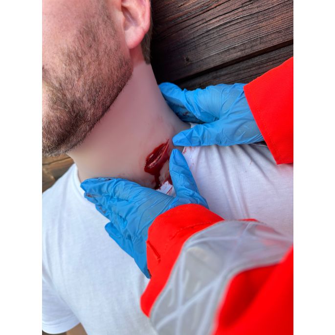 Wondmoulage Steekwond nek - afbeelding 7