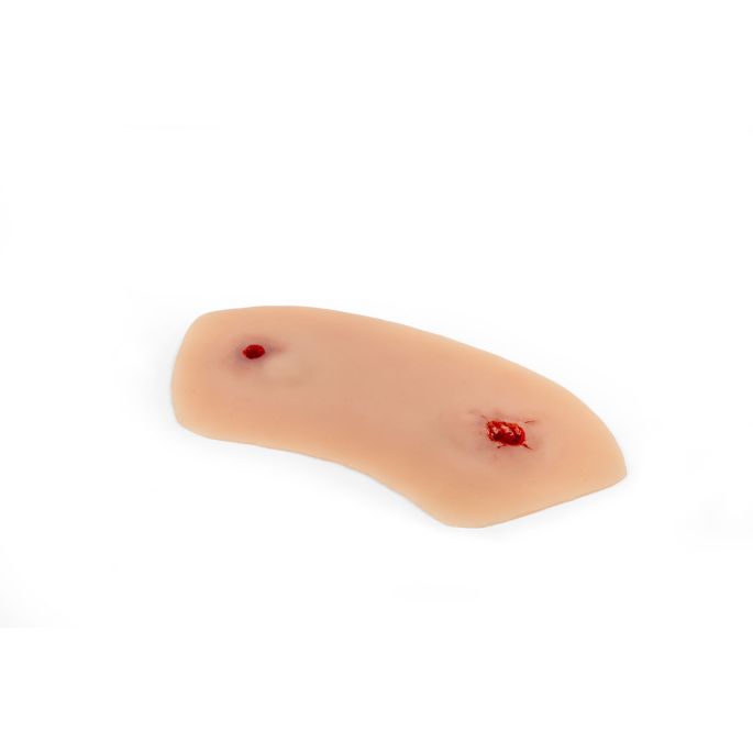 Wondmoulage shot enkelgewricht - afbeelding 4
