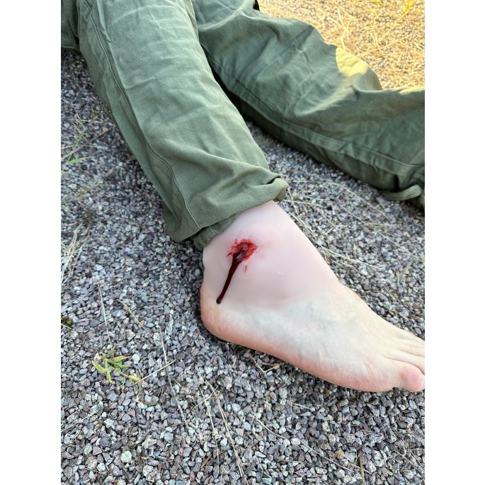Wondmoulage shot enkelgewricht - afbeelding 5