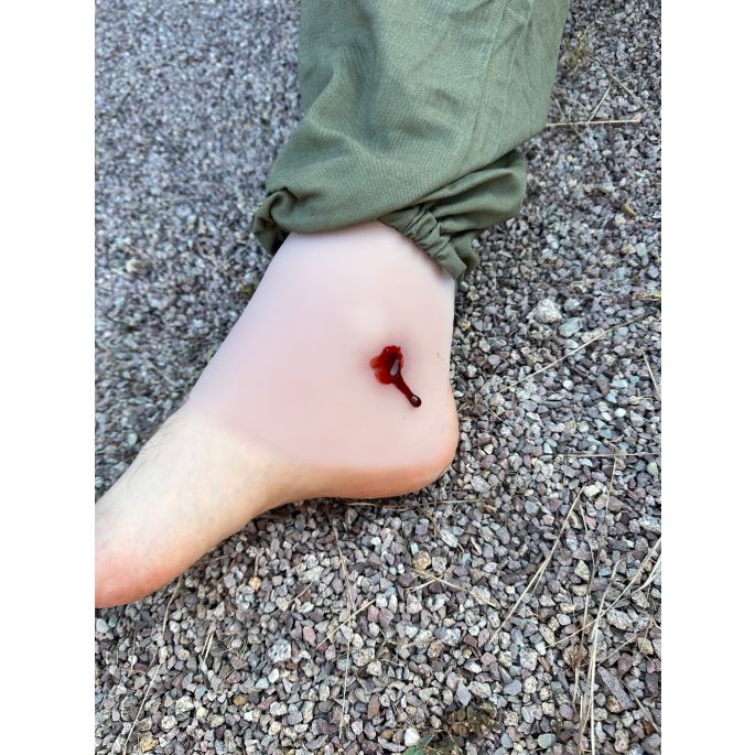 Wondmoulage shot enkelgewricht - afbeelding 6