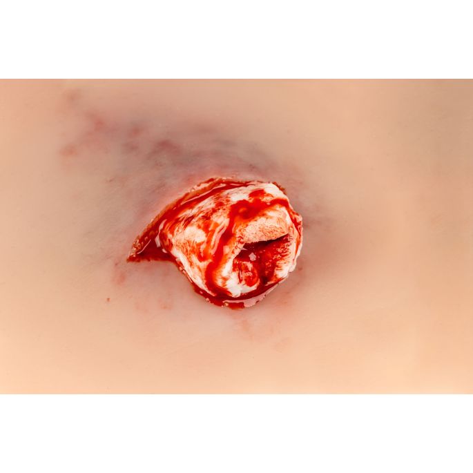 Wondpresentatie open fractuur enkelgewricht - afbeelding 5
