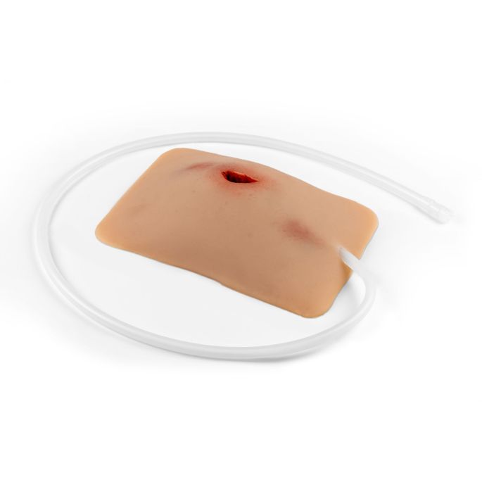 Wondmoulage steeklies