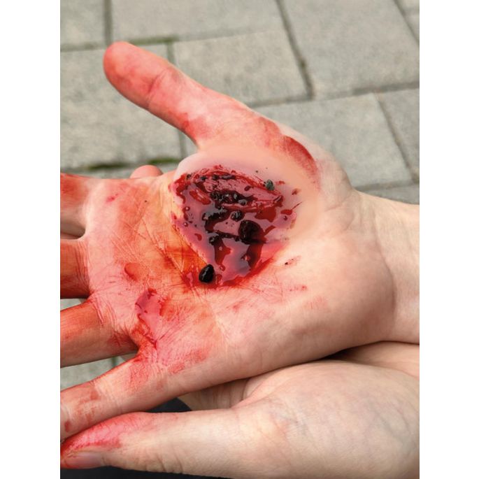 Wondmoulages - Set Standaard - afbeelding 3