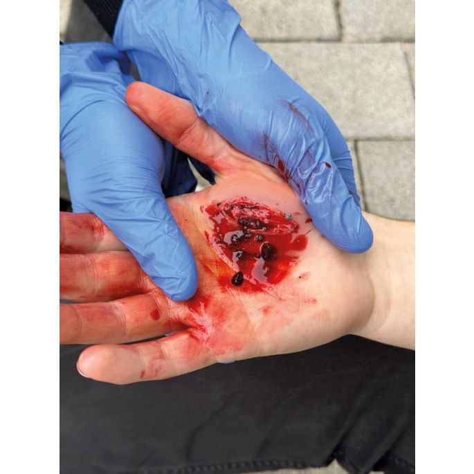 Wondmoulages - Set Standaard - afbeelding 4