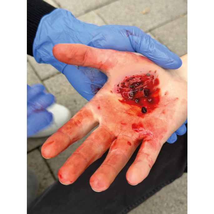 Wondmoulages - Set Standaard - afbeelding 18