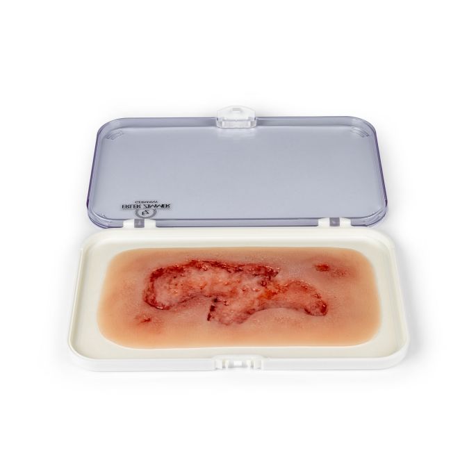 Wondmoulage arteriële beenulcus