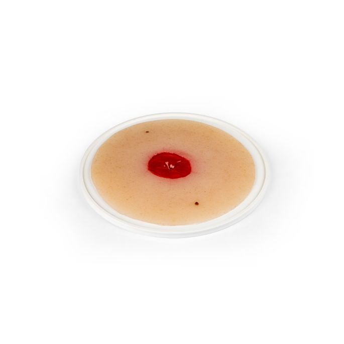 Wondmoulage verzonken colostoma, zelfklevend