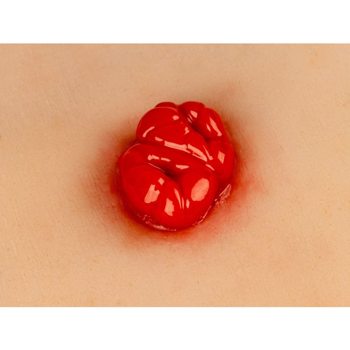 Wondmoulage dubbelloops colostoma, inclusief statief