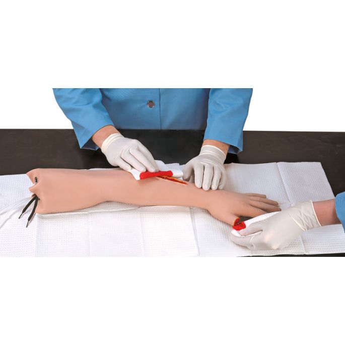 EHBO-arm