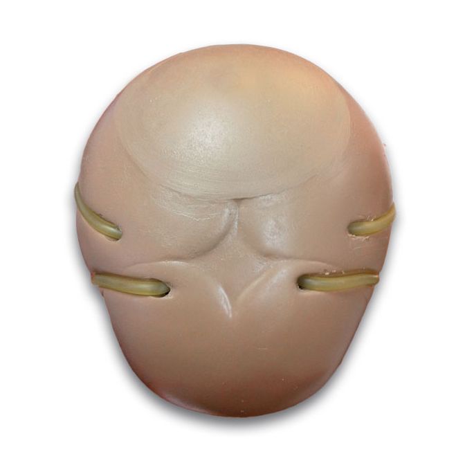 Craniale venapunctie voor R 17700