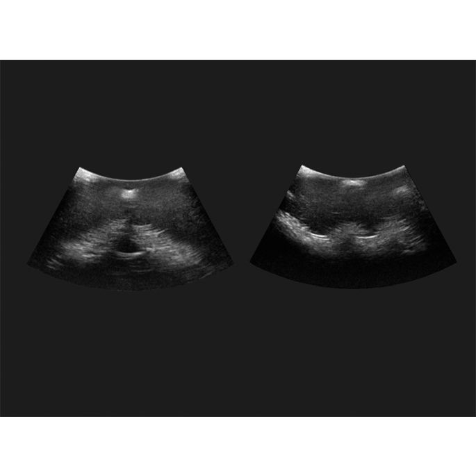 Epiduraal-spinale injectiesimulator GENESIS - afbeelding 4