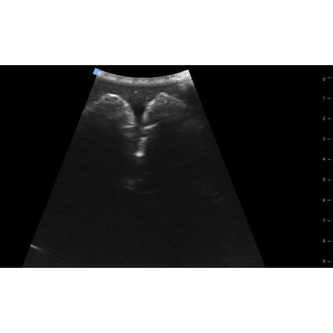 SonoEZ echografietrainer 'Urineblaas' - afbeelding 6