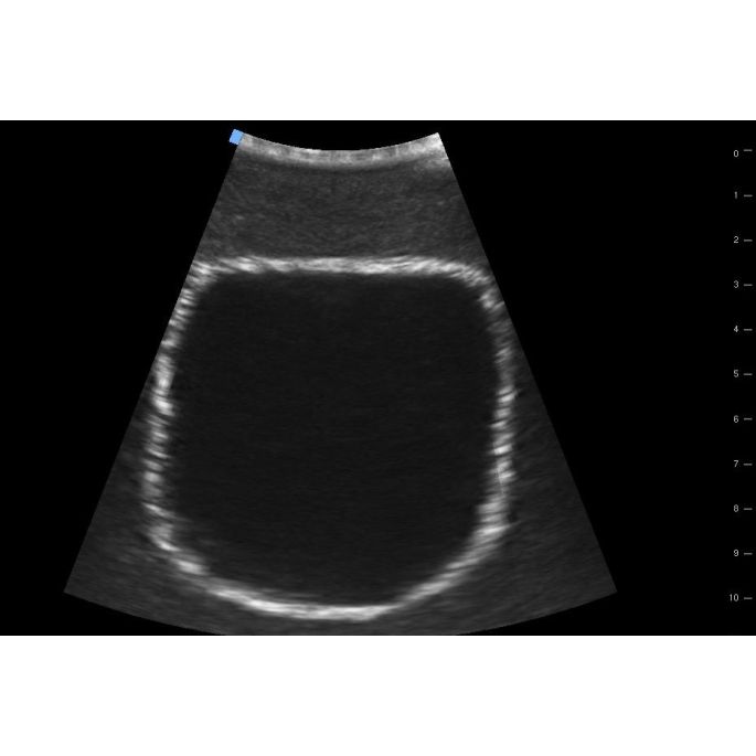 SonoEZ echografietrainer 'Urineblaas' - afbeelding 7