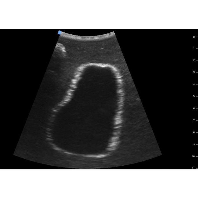 SonoEZ echografietrainer 'Urineblaas' - afbeelding 8