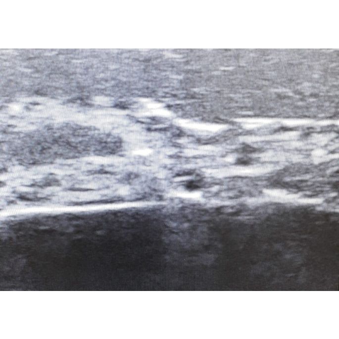 Echografie trainingsgezicht - afbeelding 5