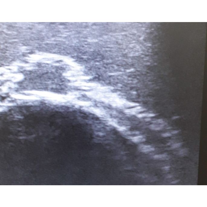 Echografie trainingsgezicht - afbeelding 6