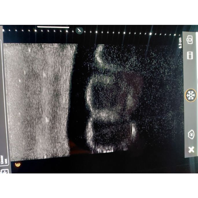 SonoEZ echografietrainer 'Hondennier' - afbeelding 6