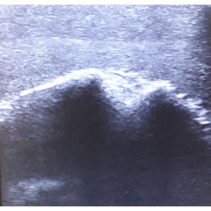 Echografie - Oefenmodel Schouder - afbeelding 6