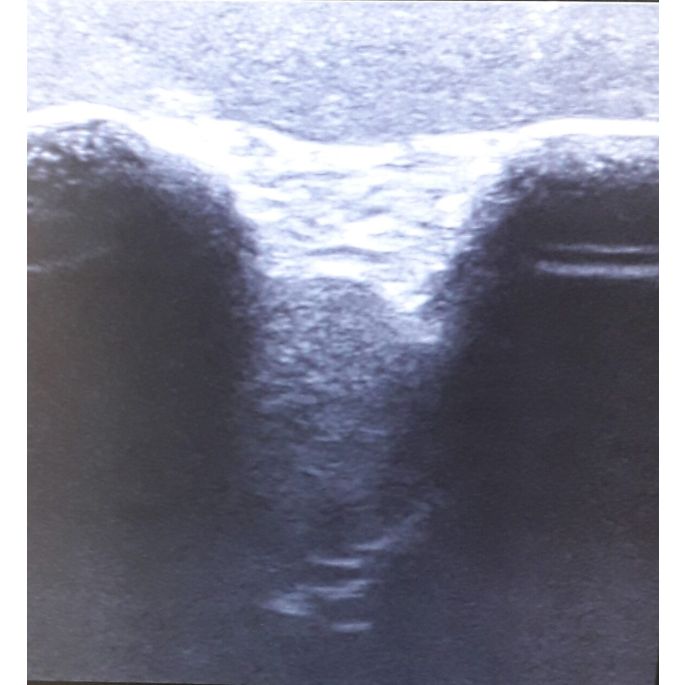 Echografie - Oefenmodel Schouder - afbeelding 7