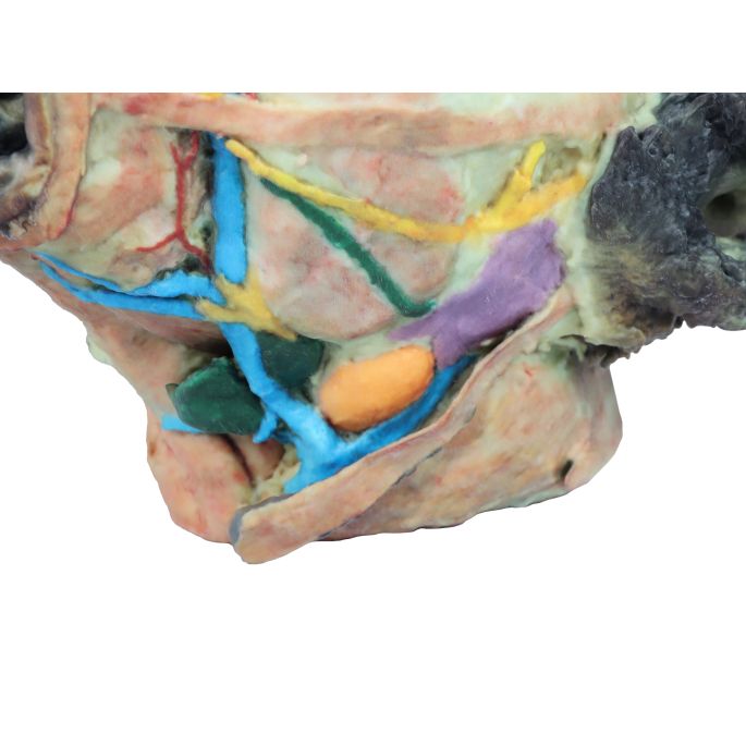 Hondenkop, oppervlakkige en diepe dissectie
