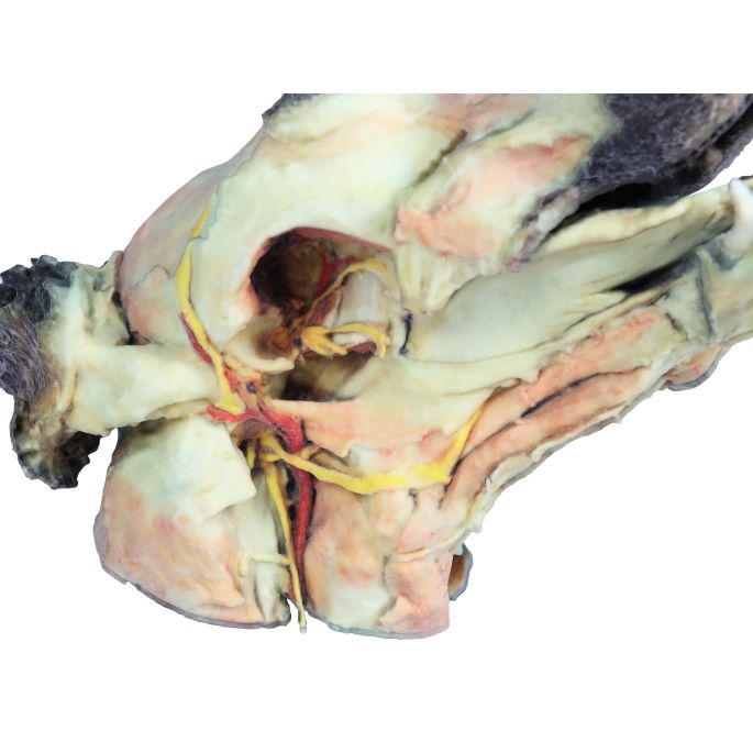 Hondenkop, oppervlakkige en diepe dissectie