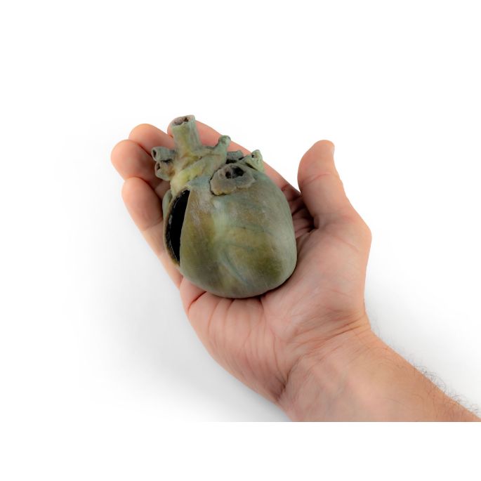 Hondenhart met dissectie