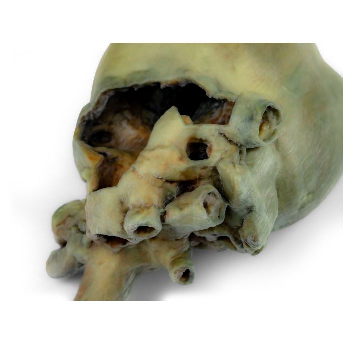 Hondenhart met dissectie