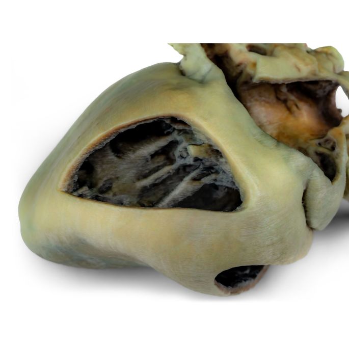 Hondenhart met dissectie