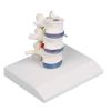 Lumbale wervels + hernia (verzakte schijf)