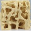 Botstructuur vergelijking: gezond vs osteoporose - afbeelding 3