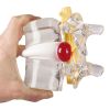herniasimulator wervelkolom - afbeelding 2