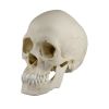 Scaphocephalische schedel