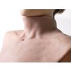 Simulatiekraag 'tracheostomie' - afbeelding 2
