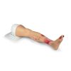 Lena Leg, been met ziektebeelden