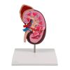 Niermodel, 2 keer levensgroot - EZ Augmented Anatomy