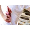 Wondmoulage gesneden, groot met bloedingsfunctie
