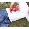 Wondmoulage gesneden, groot met bloedingsfunctie