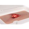 Wondmoulage open fractuur, been met bloedingsfunctie