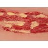 Wondmoulage veneuze beenulcus, groot, exsudatiefase
